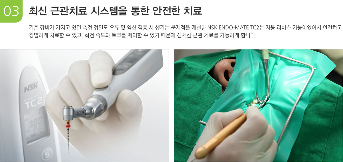 최신 근관치료 시스템을 통한 안전한 치료