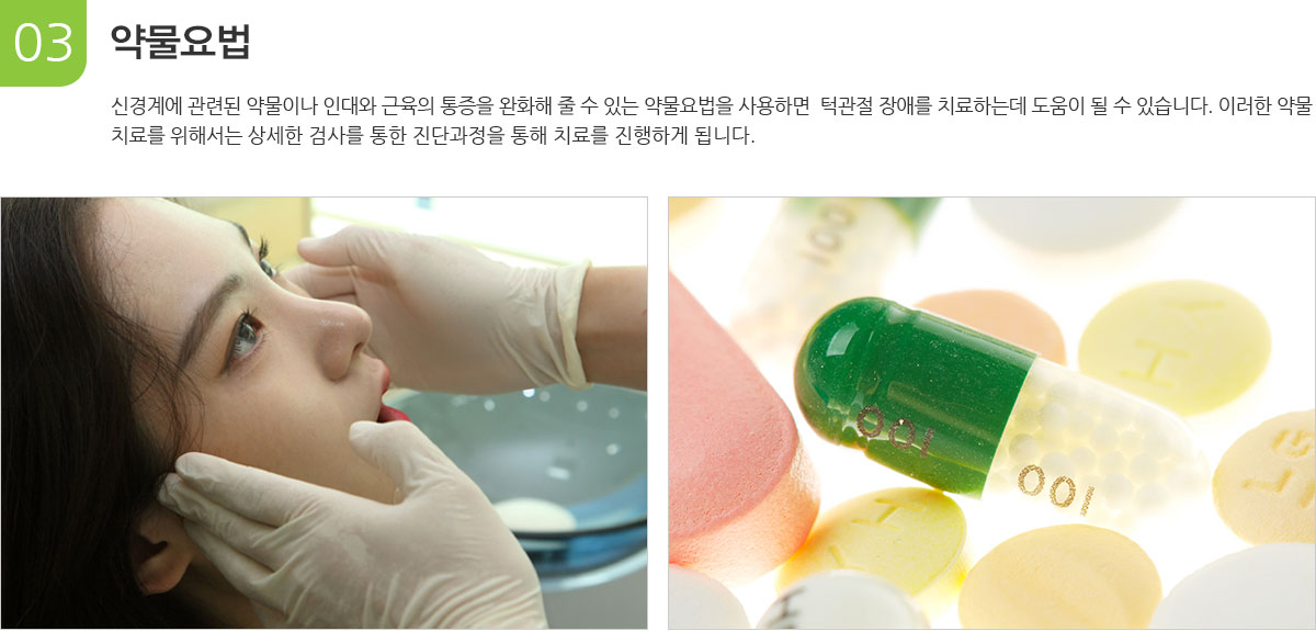 턱관절 약물요법